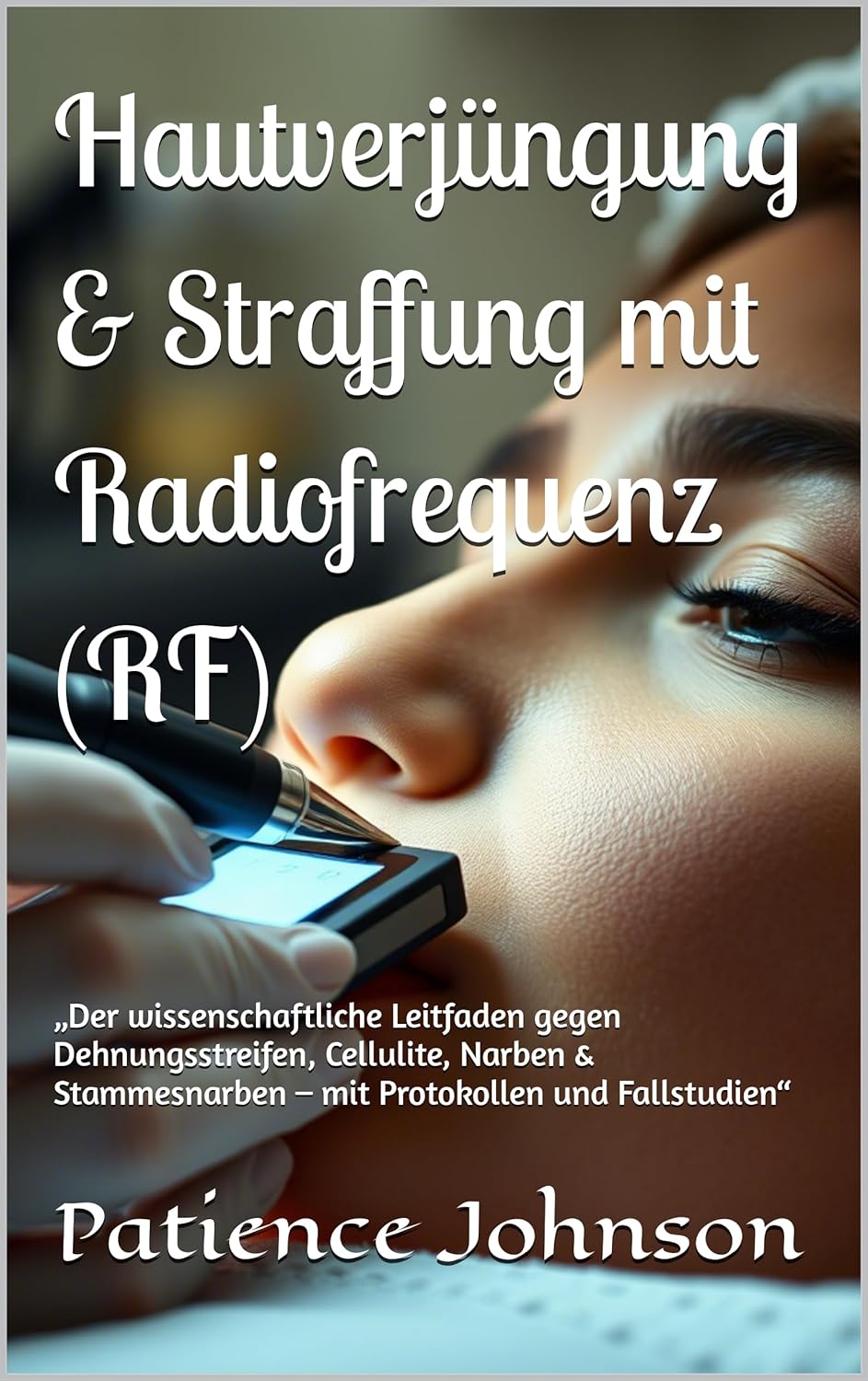 Hautverjüngung & Straffung mit Radiofrequenz (RF) Hardcover by Patience Johnson