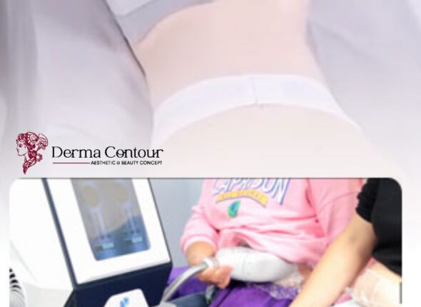 derma contour, Face-lifting using Ultherapy, Acne scar reconstruction, Warts treatment, Skin resurfacing using CO2 laser3