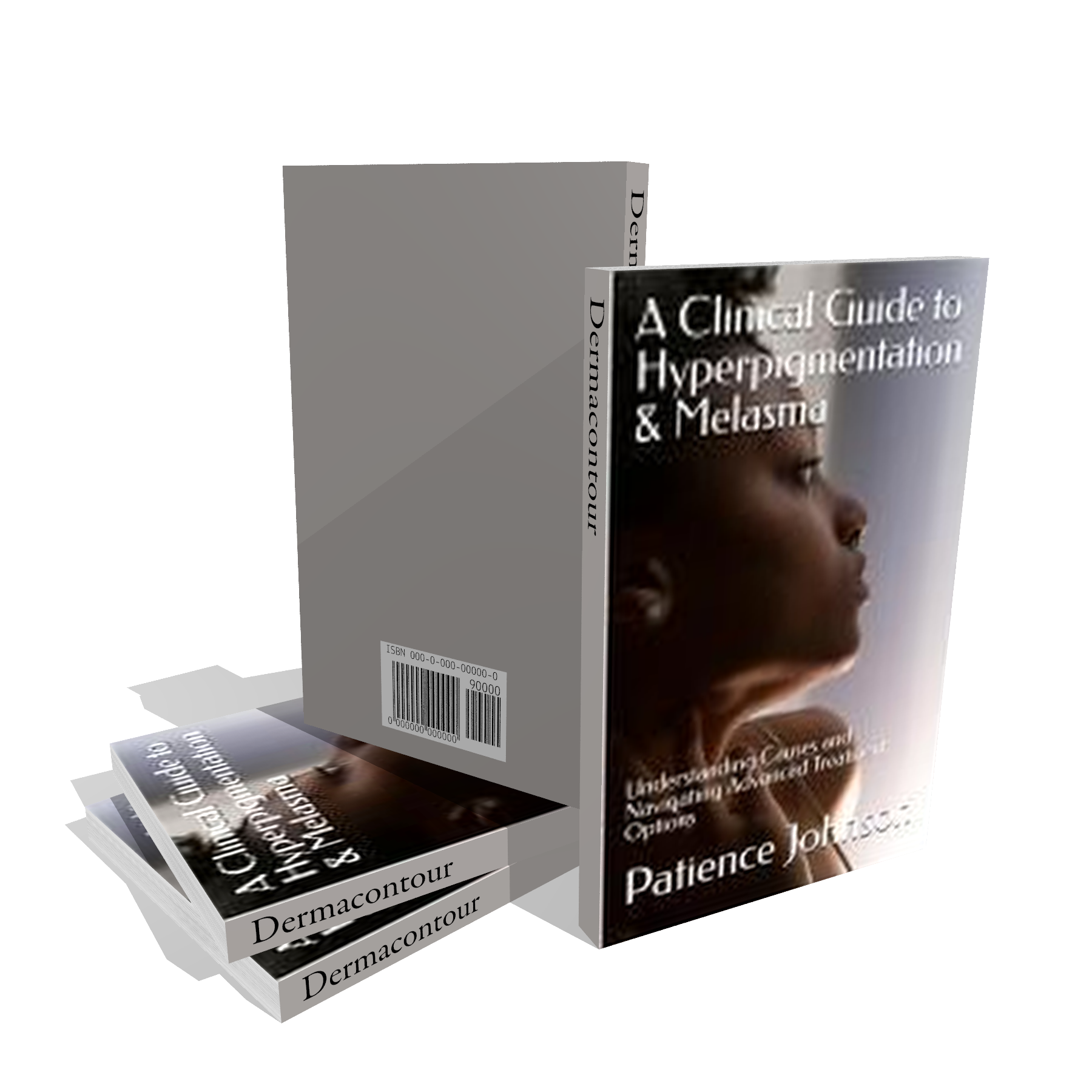 A Clinical Guide to Hyperpigmentation & Melasma - Understanding Causes and Navigating Advanced Treatment Options E-Book