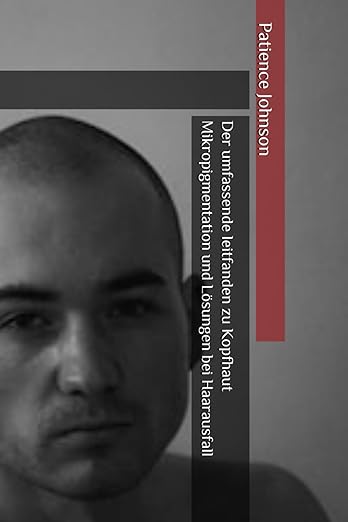 Der umfassende leitfanden zu Kopfhaut Mikropigmentation und Lösungen bei Haarausfall