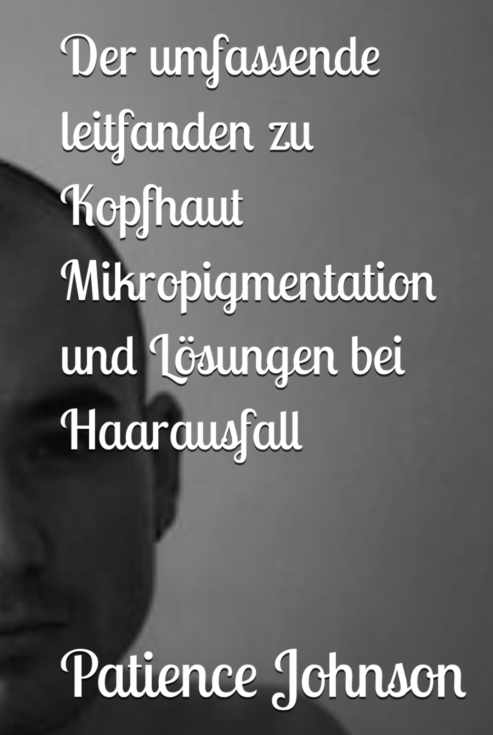 Der umfassende leitfanden zu Kopfhaut Mikropigmentation und Lösungen bei Haarausfall