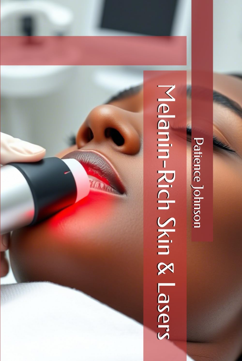 Melanin-Rich Skin & Lasers Hardcover By Patience Johnson
