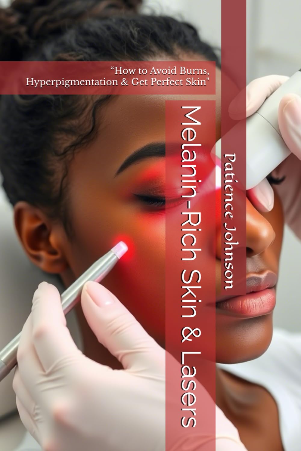 Melanin-Rich Skin & Lasers Paperback By Patience Johnson