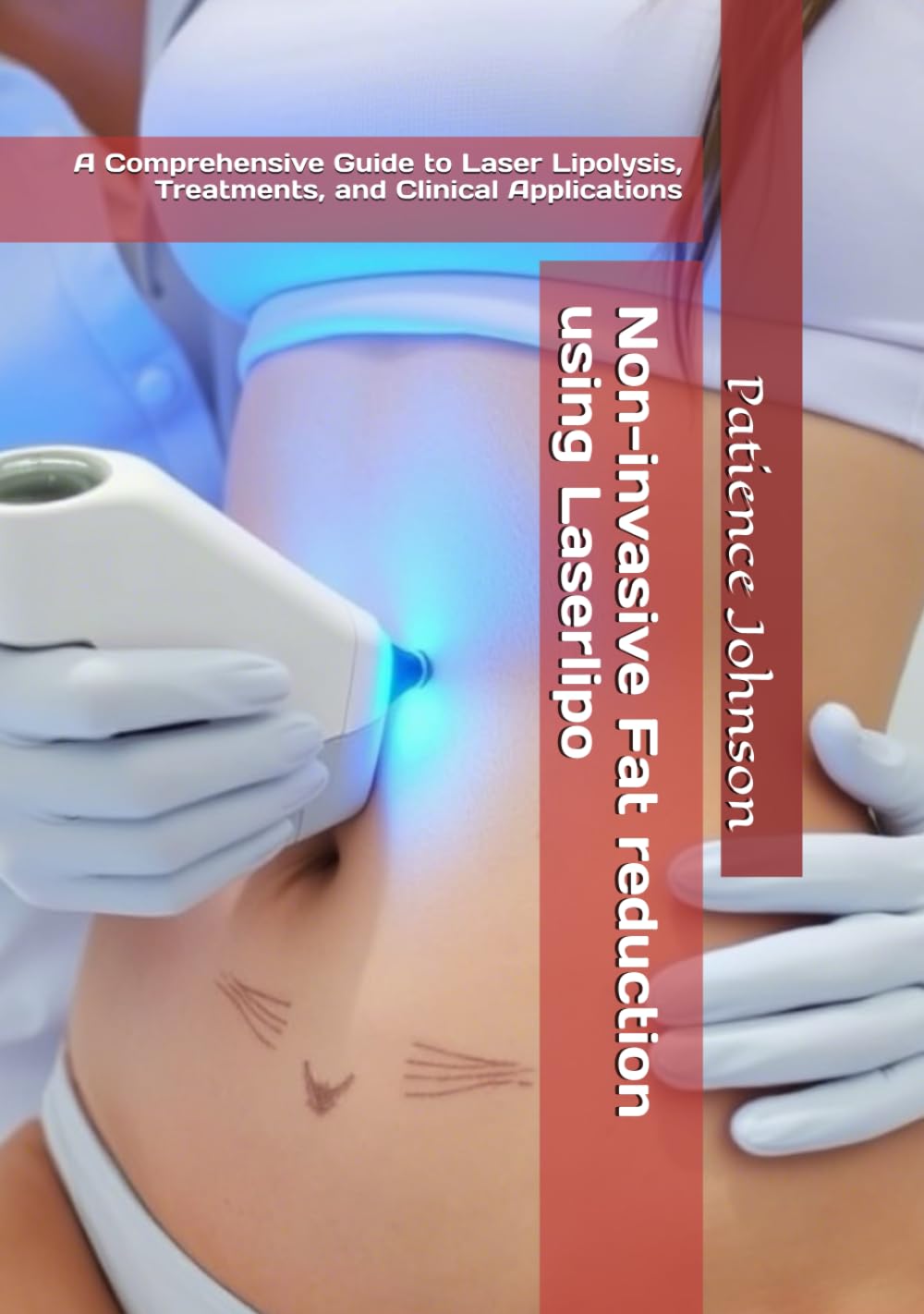 Non-invasive Fat reduction using Laserlipo hardcover By Patience Johnson