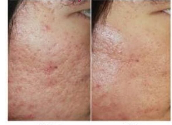 derma contour