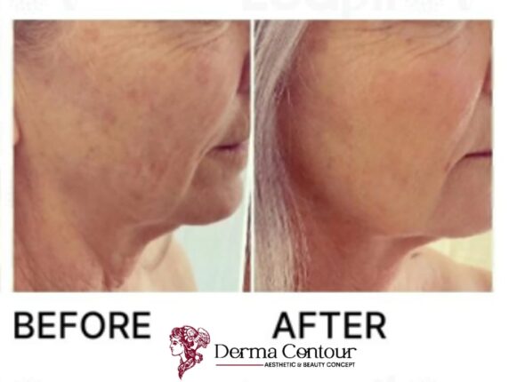 the derma academy Germany14