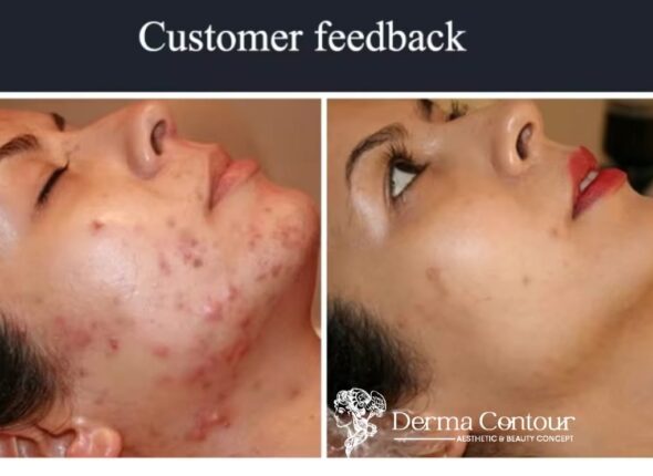 the derma academy Germany19